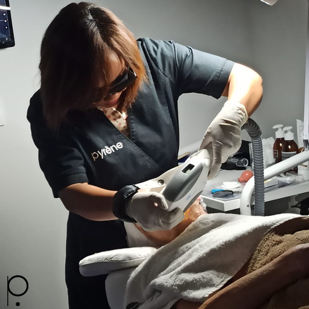 Epilation par Lumière Pulsée - Pyrène Epilation Définitive