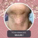 Vous n’êtes pas SEULES ! (4)